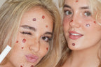 Pimple patches (Limited edition)
